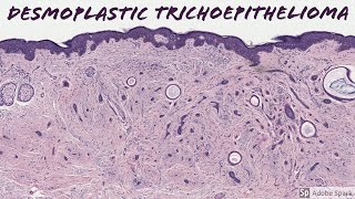 Ultrasound of Common Adnexal Cysts [upl. by Remled344]