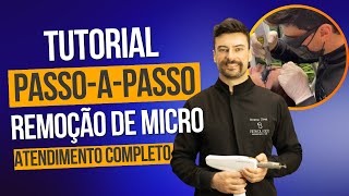 Passoapasso de um atendimento completo de remoção de micropigmentação de sobrancelhas a laser [upl. by Nadler233]