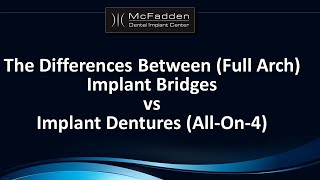 Implant Bridges vs Implant Dentures AllOn4 [upl. by Skrap431]