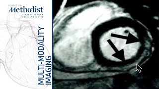 Cardiomyopathies I Complementary Roles of Echo amp CMR MQuiñones MD DShah MD January 26 2021 [upl. by Pol]