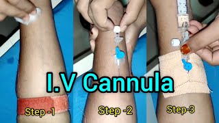 IV Cannulation Step by Step kaise lagaye  Veinflow kaise lagaye iv cannula fixation GNM Nursing [upl. by Nifled]