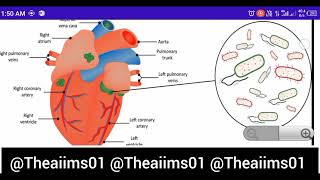 Endocarditis Cardiovascular diseasesdisorders [upl. by Martin293]