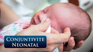 Conjuntivite Neonatal Prevenção e Tratamento Essenciais para RecémNascidos [upl. by Ynnelg123]