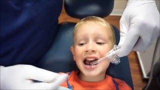 Fluoride Varnish Application [upl. by Eudosia218]