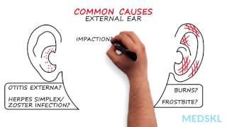 Ear Nose and Throat – Otalgia Ear Pain By Russell Hollins MD [upl. by Hamirak]