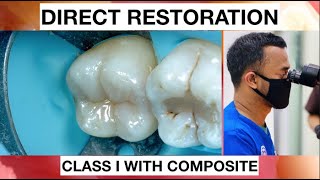 Step by Step Layering Composite I Simple Way  General Dentist Griya RR [upl. by Akihsar270]