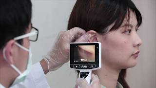 HD Digital Otoscope  Instructions for Usage  CEI Technology Inc [upl. by Burr]