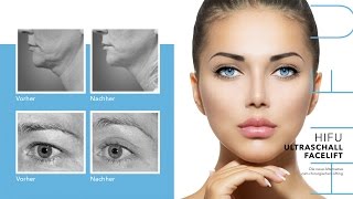 HIFU Ultraschall Facelift  Mit Ultraschall Gesicht behandeln [upl. by Heller268]