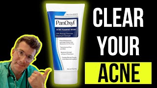 Doctor explains how to use BENZOYL PEROXIDE for ACNE aka PanOxyl  Acnecide  Side effects amp more [upl. by Casia]