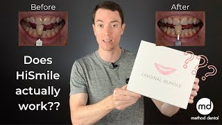 HiSmile Review By A Dentist Dr Grant McGrath [upl. by Buck]