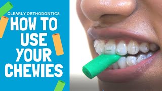 How to use Chewies  Invisalign Treatment [upl. by Lian]