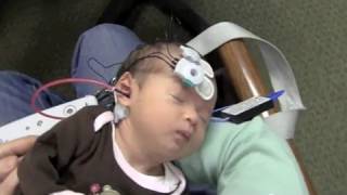 Newborn Hearing Testing Screening OAE and ABR [upl. by Zzabahs]