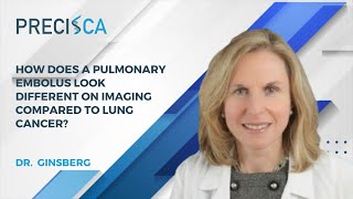 How does a pulmonary embolus look different on imaging compared to lung cancer [upl. by Eanyl]