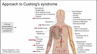 Approach to Cushings syndrome [upl. by Conrad43]