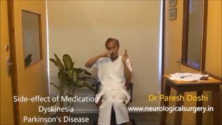 Dyskinesia in Parkinsons Disease [upl. by Razec125]