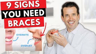 9 Signs you Need Braces  Overjet overbite crowding [upl. by Grenier]