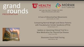 Abnormal Eye Movements Pseudotumor Cerebri Syndrome Thyroid Eye Disease Visual Field Testing [upl. by Akiam]