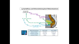 Lymphabfluss und Höheneinteilung beim Rektumkarzinom  Strahlentherapie Prof Hilke Vorwerk [upl. by Tudor]