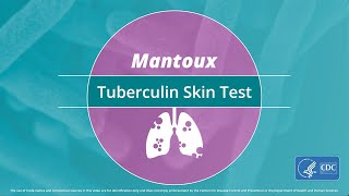 Mantoux Tuberculin Skin Test Video [upl. by Ynos]