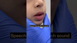 Speech Therapy  Articulation ch Sound  Tongue Positioning  Mis articulation  Teach Sound [upl. by Barstow]