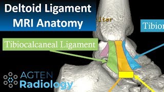 MRI Anatomy of Ankle Ligaments Deltoid Ligament [upl. by Enaej]