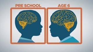 How baby brains develop [upl. by Lombardy671]