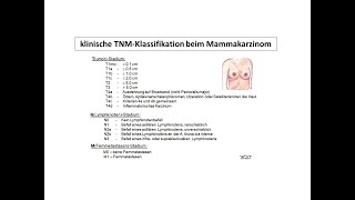 klinische Stadieneinteilung beim Mammakarzinom TNMStadium  Strahlentherapie Prof Hilke Vorwerk [upl. by Merwin795]