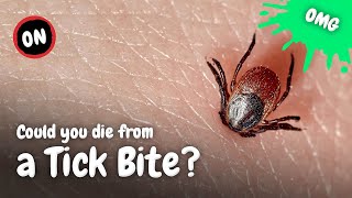 What Happens to Your Body When Youre Bitten by a Tick [upl. by Sven]