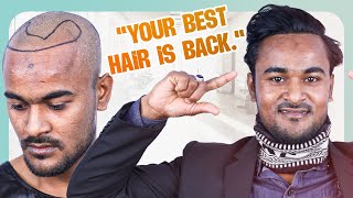 Hair Restoration Success Grade 3 Baldness 😃  Bangladesh  New Roots [upl. by Lawrence822]