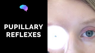 Pupillary Reflexes  OSCE Guide Clip  UKMLA  CPSA [upl. by Annirak]