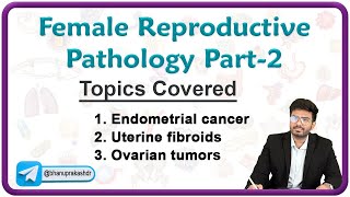 Female Reproductive Pathology Part  2  Endometrial cancer Uterine fibroids and Ovarian tumors [upl. by Persas321]