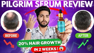 Pilgrim Redensyl and Anagain Advanced Hair Growth Serum Review [upl. by Naeroled]