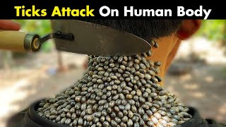 Ticks Bites On Human  Symptoms Causes And Treatment [upl. by Birchard]