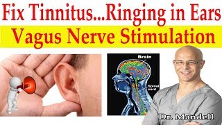 Fix Tinnitus Ringing in Ears Major Breakthrough How to Stimulate Vagus Nerve  Dr Alan Mandell DC [upl. by Lemrej139]