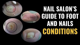 Nail Salons Guide To Foot and Nail Conditions [upl. by Nynahs]