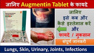 Augmentin 625 mg tablet  Uses Side Effects Dosage Precautions Price augmentin [upl. by Junko]