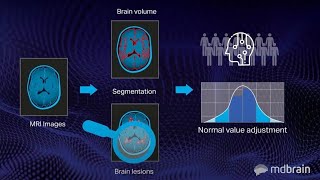 mdbrain  neuroimaging  tutorial [upl. by Ecirtnahs314]