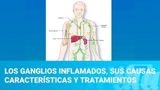 Los ganglios inflamados sus causas características y tratamientos [upl. by Ial]