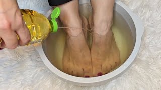 I soaked my feet in APPLE CIDER VINEGAR and 15 minutes later I was shocked at what happened [upl. by Sascha]