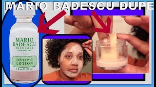 Mario Badescu Drying Lotion DUPE  How To Dry Out Pimples Fast AF [upl. by Aronoh336]