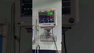 NIV ventilator support hospital icu [upl. by Niltyak]