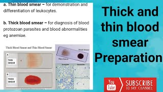 Thick and thin blood smear preparation [upl. by Rakabuba644]