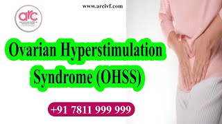 Ovarian Hyperstimulation Syndrome OHSS  ARC Kovai [upl. by Derte]