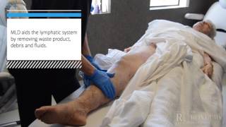 Manual Lymphatic Drainage MLD PostLipedema Surgery [upl. by Adihaj]