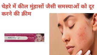 Acne Toin Plus Gel Use In Hindi acnetreatment pharmacist knowledge [upl. by Auahsoj]