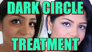 How To Treat dark Under Eye Circles At home SuperPrincessjo [upl. by Doss997]