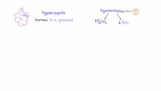 Hypoventilation [upl. by Licha]