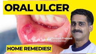 Understanding Oral Ulcers Causes Symptoms and Treatment Options [upl. by Bradan]