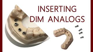 How To Insert DIM Analogs In A 3D Printed Model  Dental Lab Learning [upl. by Josepha805]