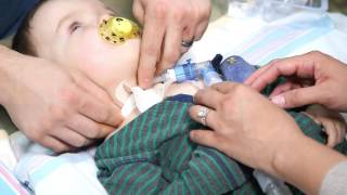 How to Do a Routine Trach Change  Cincinnati Childrens [upl. by Htebaras]